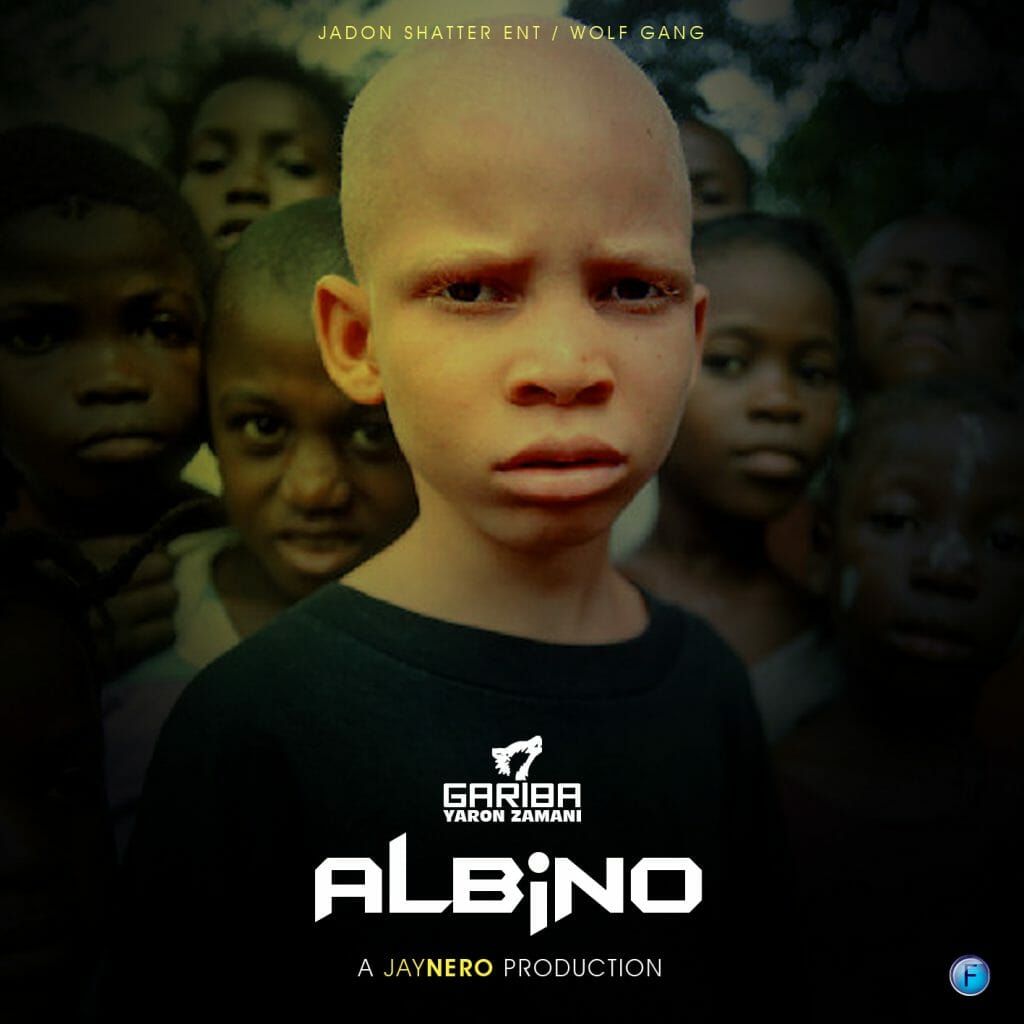 Gariba – Albino (Prod. By Jaynero Muzik)